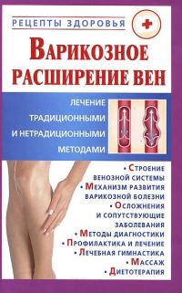 Обложка книги «Варикозное расширение вен.»