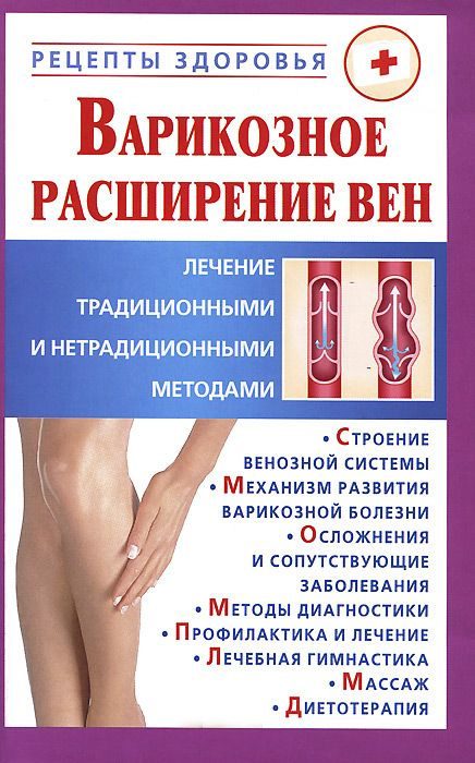 Обложка книги «Варикозное расширение вен.»