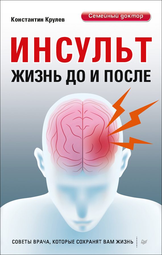 Обложка книги «Инсульт. Жизнь до и после»