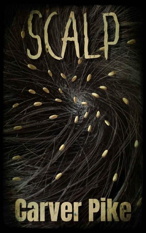 Обложка книги «Scalp»