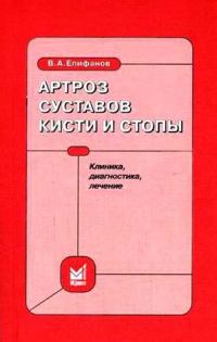Обложка книги «Артроз суставов кисти и стопы: клиника, диагностика, лечение»
